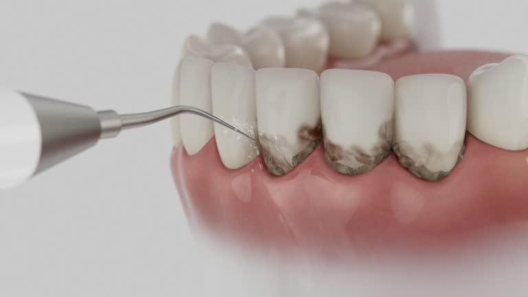 Reliable Dental Implants contractor in Krum, TX by Smile Center Dentistry